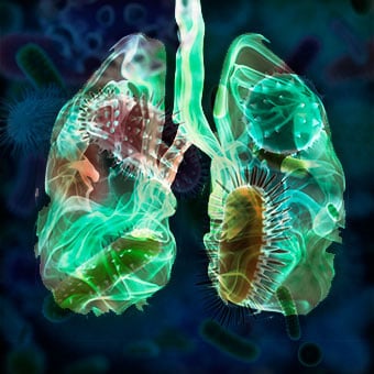 A variety of respiratory infections can turn into pneumonia.