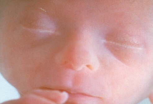 Human fetus near his fifth month of development.