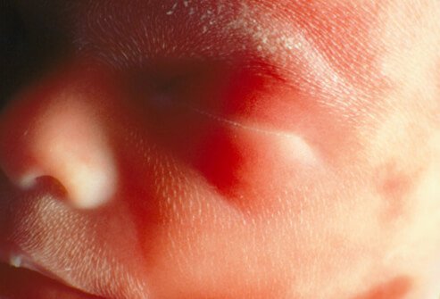 Human fetus at approximately 24 weeks showing details of his closed eyes, nose, mouth, and facial hair.