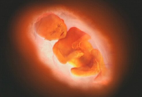 Human fetus in utero at approximately 36 weeks.