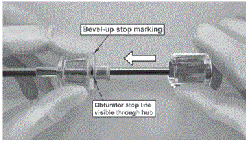 Withdraw the cannula until the hub is flush with
the obturator, and then twist the obturator clockwise to lock onto the cannula - Illustration