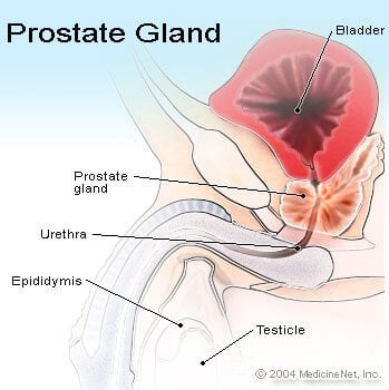 An enlarged prostate gland is a common problem that men face as they get older.
