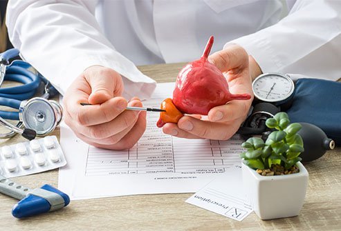 Prostate cancer is a cancer that develops in the prostate gland in men and it is one of the most common types of cancer. In some cases, it can take up to eight years to spread from the prostate to other parts of the body (metastasis), typically the bones. In other cases, it may be more aggressive.