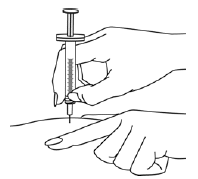 Insert the needle straight down at a 90-degree angle - Illustration