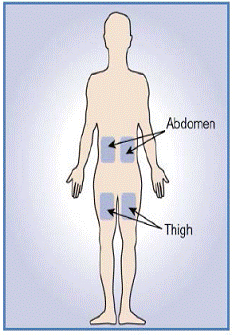 Choose an Injection Site - Illustration