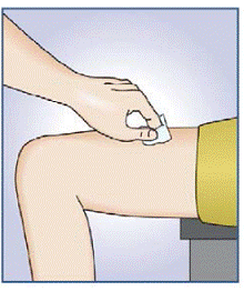 Wipe the area with an alcohol swab - Illustration