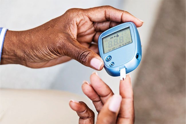 Diabetes may damage blood vessels and nerves in and around the eyelids that may cause droopy eyelids.