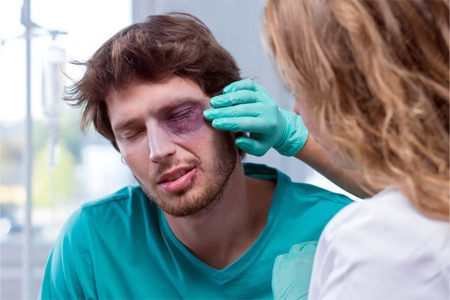 If you injure your levator muscles, it may cause droopy eyelids.