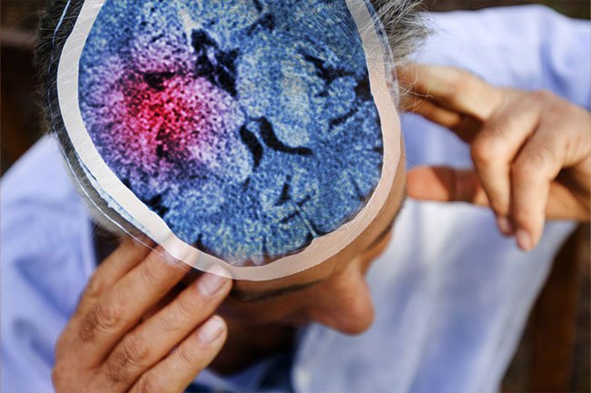 Brain conditions such as stroke and traumatic brain injury may cause your hands to shake.
