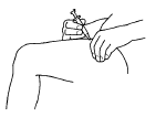 Push the needle about 1/4 inch into the pinched skin - Illustration