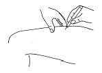Insert the needle into the pinched skin - Illustration