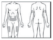 Injection sites - Illustration