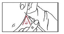 Insert the full length of the needle into the skin at a 45-degree angle with a quick “dart-like” motion - Illustration