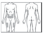 Injection site - Illustration