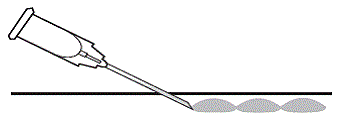 Serial threading -  Illustration