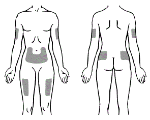 Recommended sites for injection - Illustration