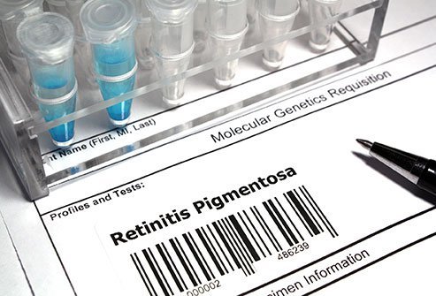 Genetic tests can identify genes associated with retinitis pigmentosa.