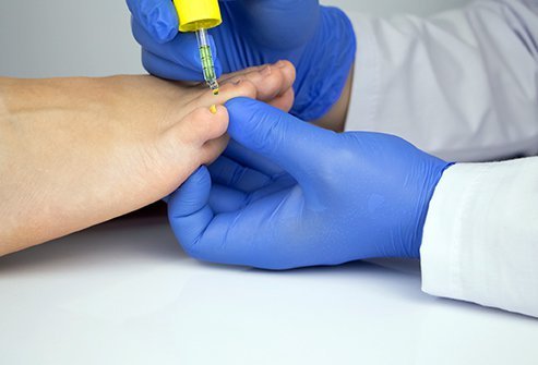 Ringworm is a fungal infection that appears on the skin, anywhere over the body. 