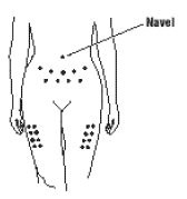 Choose an injection site - illustration