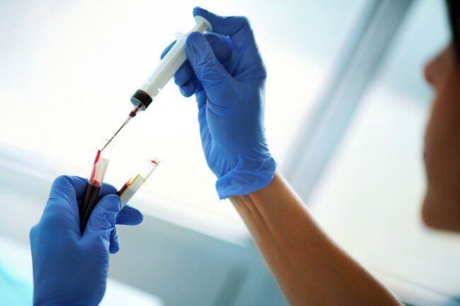 Some sexually transmitted infections (STIs) have mild symptoms or none at all.