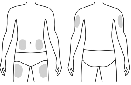 Injection sites - Illustration