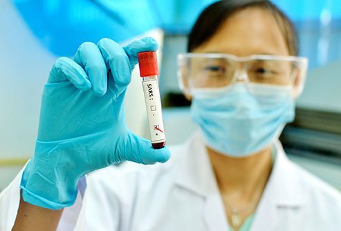 SARS causes a decrease in white blood cells and platelet (clotting cell) counts in the blood.