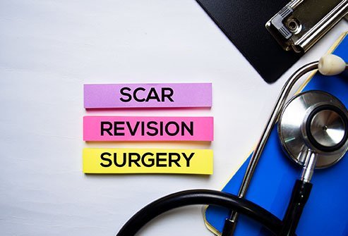 Scar revision helps in making the scar less noticeable and more cosmetically appealing