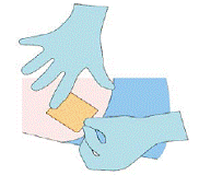 Apply dressing to the insertion
site - Illustration