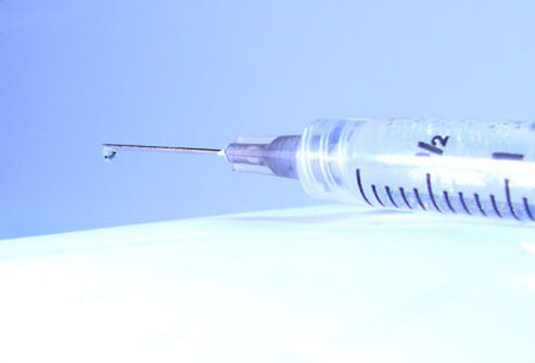 Spinal injection of cortisone medication (steroids) can be beneficial for severe sciatica.