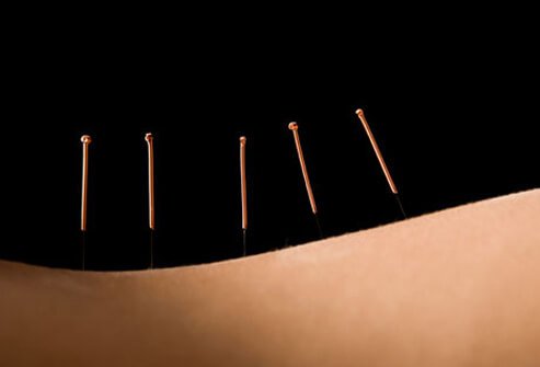 Adjunctive therapies, such as massage, yoga, osteopathic & chiropractic care, and acupuncture, can sometimes be helpful for back pain.