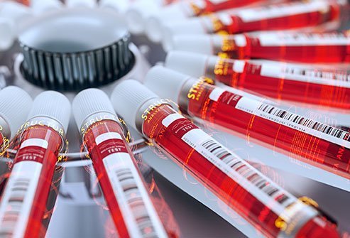 What Is a Monoclonal Antibody for COVID-19
