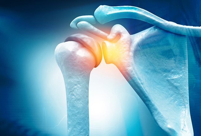 can a torn rotator cuff heal on its own