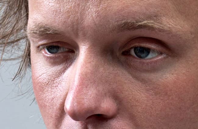 Lack of moisture leads to a loss of skin elasticity and you may get under eye bags.