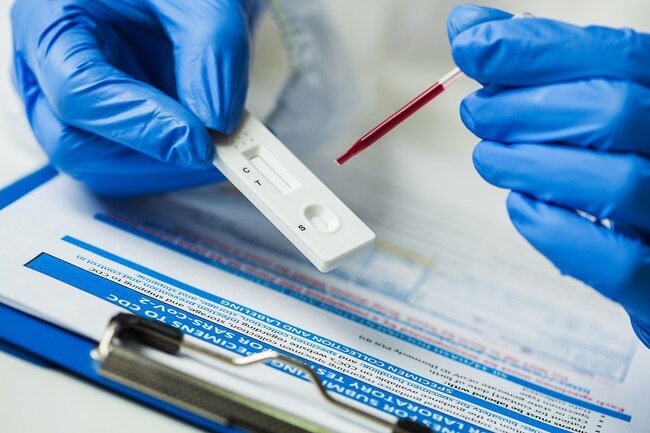 Antibodies are proteins your body makes to help fight off an infection.