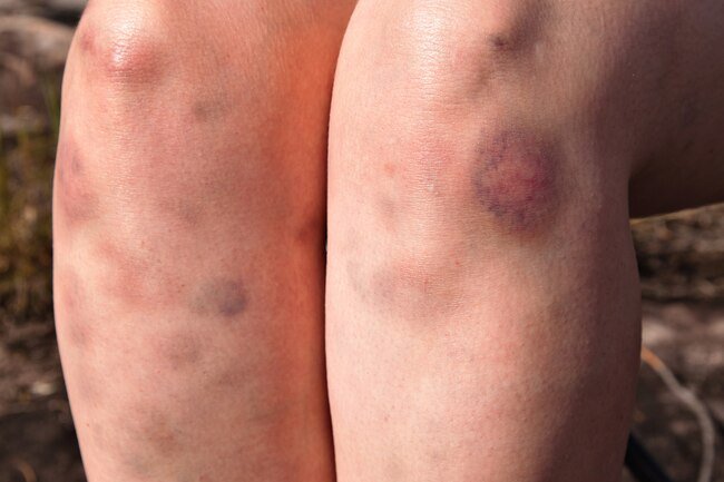 Your body has more collagen than any other protein.