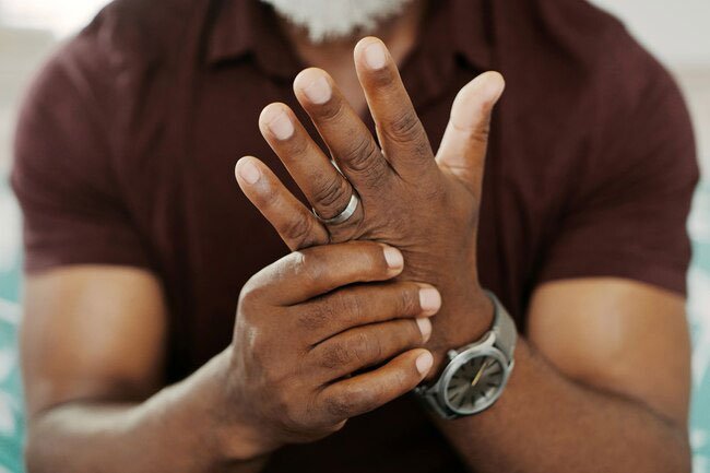 Arthritis comes in many forms.
