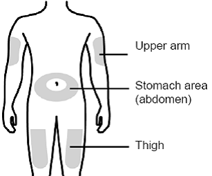 Gather all materials needed for your injection. - Illustration