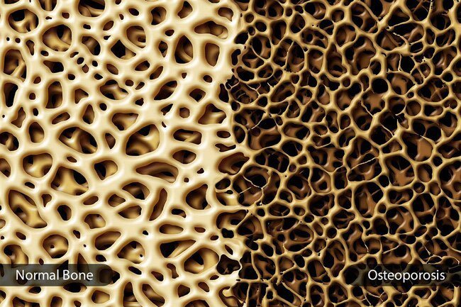 If you are like most Americans, you probably do not get enough of this mineral to keep your bones healthy.