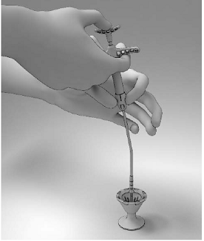 While maintaining steady downward pressure on the Thumb Rest, slowly release the Finger Rests with the index and middle fingers until the Cup lowers and captures all ends of the SINUVA Sinus Implant - Illustration