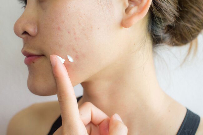 Natural oils can clog your pores.