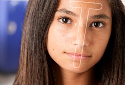 With normal/combination skin, you might have an oily 'T-Zone' (forehead, nose, and chin) and dry skin elsewhere.
