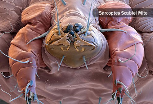 Skin parasites including tiny, burrowing creatures like scabies and hookworms, and others that breed on your skin, like head lice.