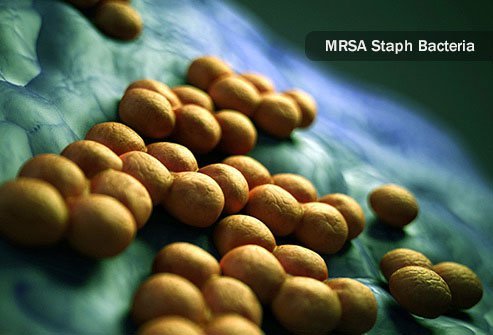 These bacteria have developed a gene called mecA that keeps standard antibiotics like penicillin.