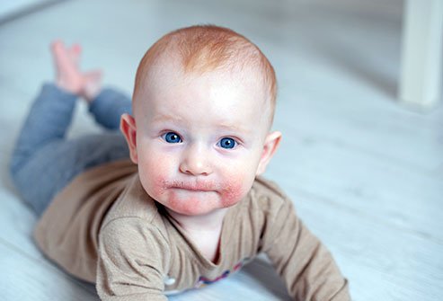 Rashes are abnormal changes in skin color and texture. Hives, eczema, hear rash, contact dermatitis, folliculitis and swimmer's itch are some causes of childhood skin rashes.