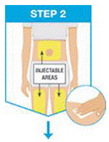 Injectable Areas - Illustration