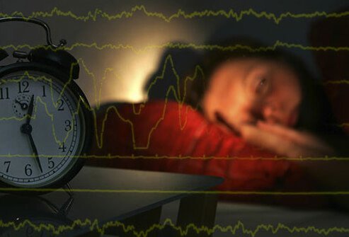 Sleep disorders are conditions that impair a person's ability to get normal, restorative sleep.