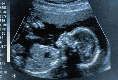 Not only do female smokers have a harder time conceiving, but their risk of problems in pregnancy also increases.