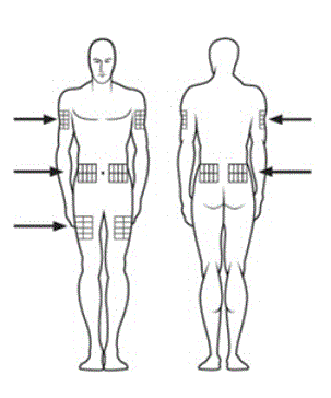 Injection sites -  Illustration