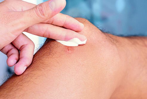 Managing your wound is the first priority when treating a brown recluse spider bite.