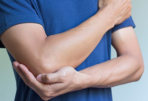 A man with tennis elbow cupping his elbow in pain.